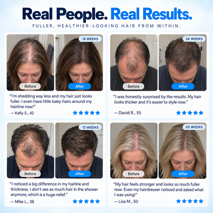 Biotin Hair Growth Gummies